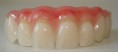 /album/estheticproteseodontologica/dentes-409-jpg/